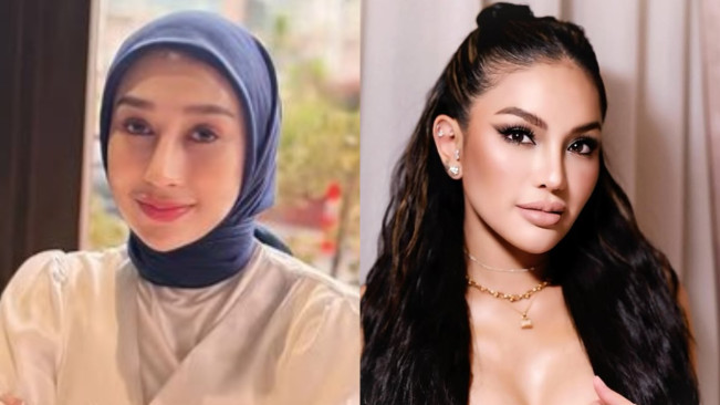 Rekam Jejak Reza Gladys, Dokter Kecantikan yang Berhasil Penjarakan Nikita Mirzani